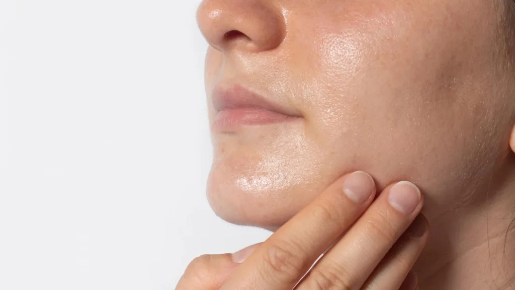 Oily Skin: Causes, Care, and Control