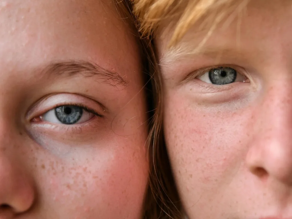 Dark Circles No More